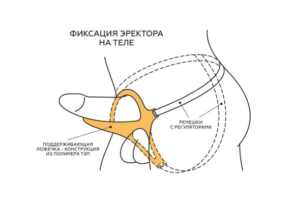 Телесный эректор-ложечка с фиксацией на ремешках MEN STYLE Телесный эректор-ложечка с фиксацией на ремешках MEN STYLE
