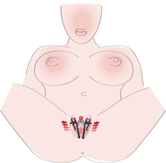 Зажим на половые губы с гибкой перемычкой для G-стимуляции Зажим на половые губы с гибкой перемычкой для G-стимуляции